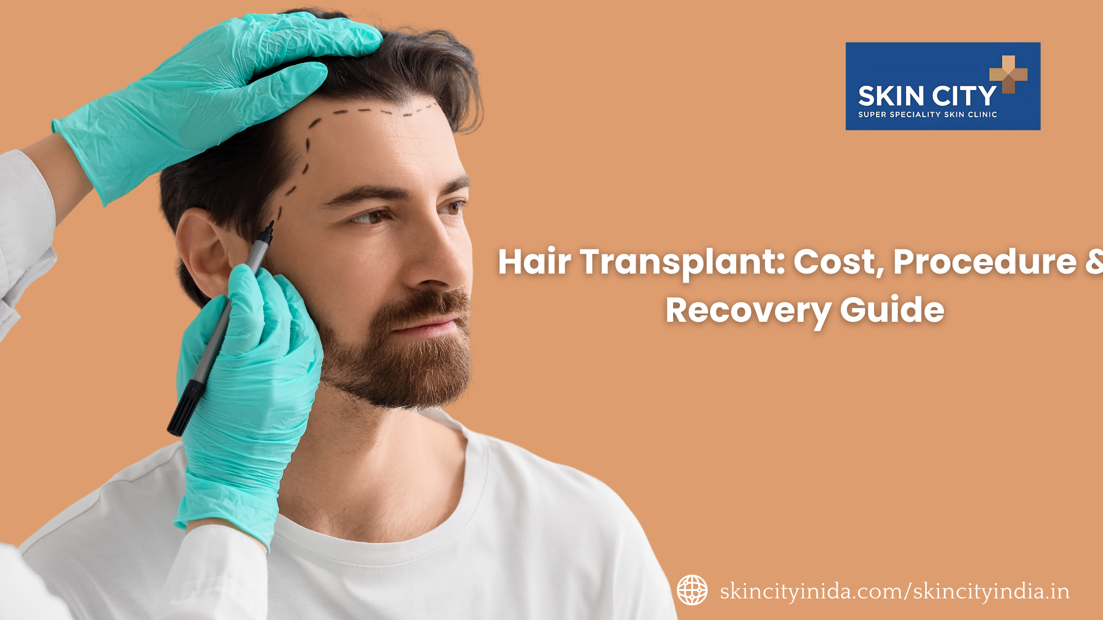 Hair Transplant: Cost, Procedure & Recovery Guide